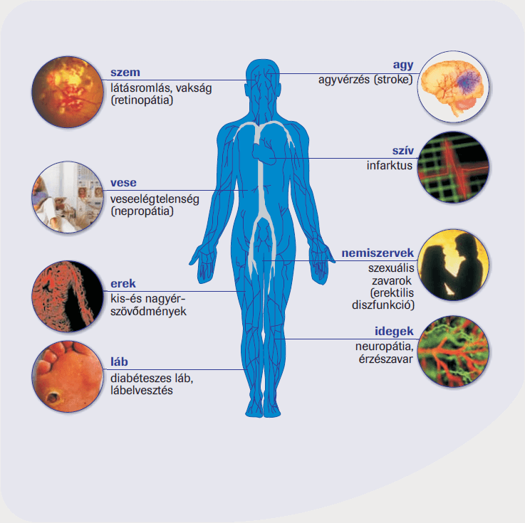 a kezelés a nemi szervek diabetes mellitusban